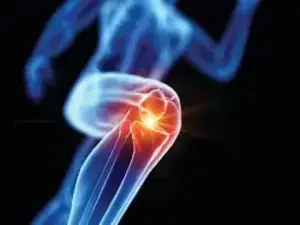 radiologic image of knee